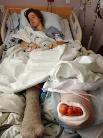 First night after the surgery - totally wiped out.